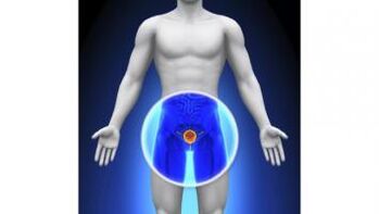 bir erkekte prostatit