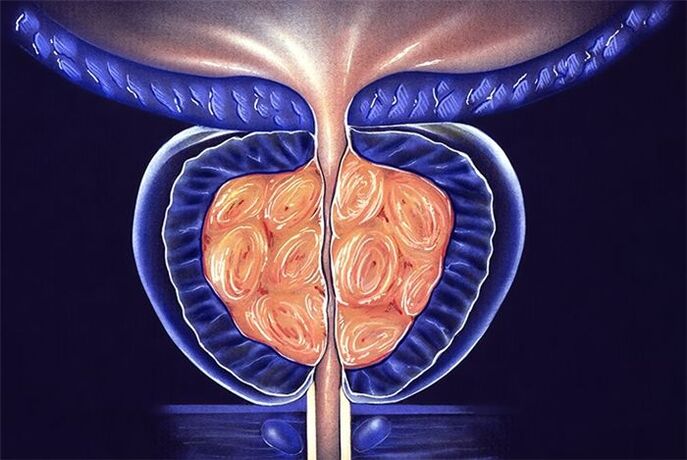 prostatit belirtileri ve tedavisi