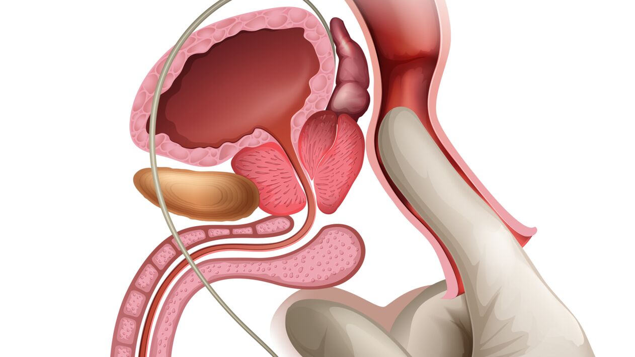 Prostat masajı konjestif prostatit tedavisinde etkili bir yoldur
