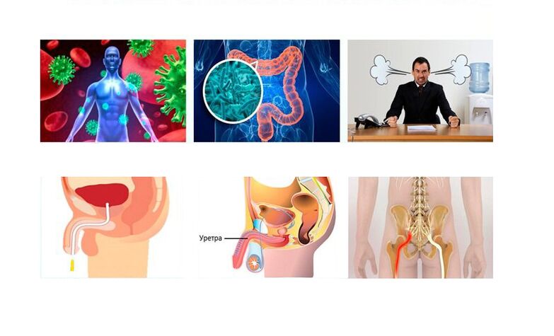 prostatit nedenleri